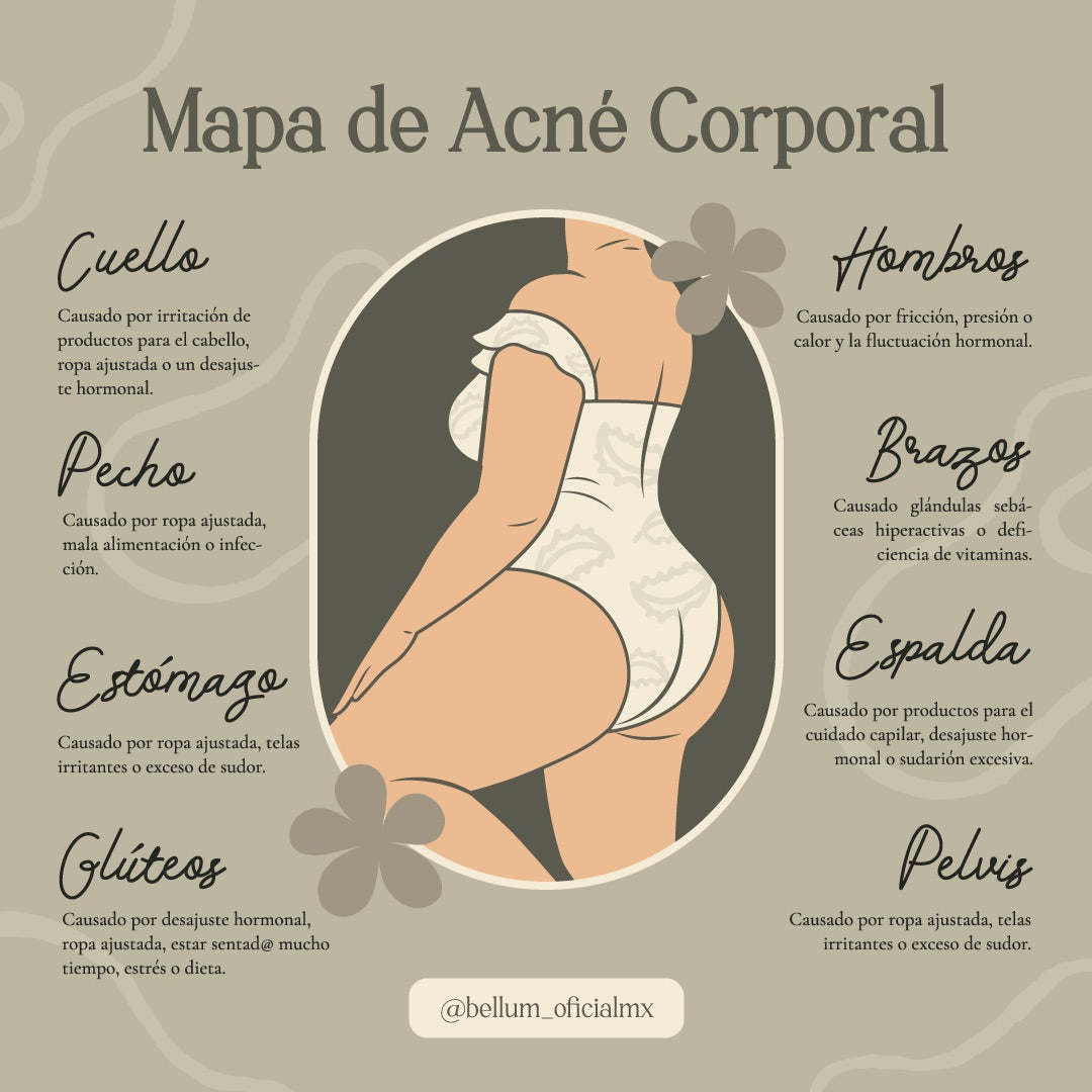 Mapa de acné corporal